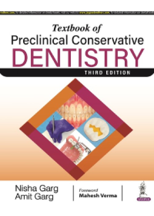 Textbook of Preclinical Conservative Dentistry NISHA GARG